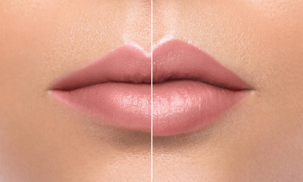 dudak-dolgusu dudak-dolgusu