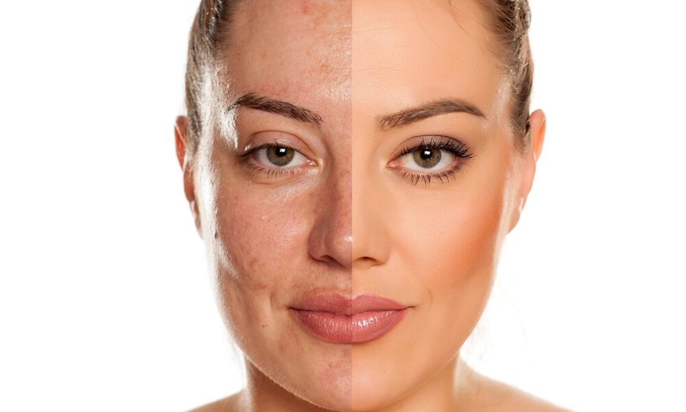 mezoterapi mezoterapi