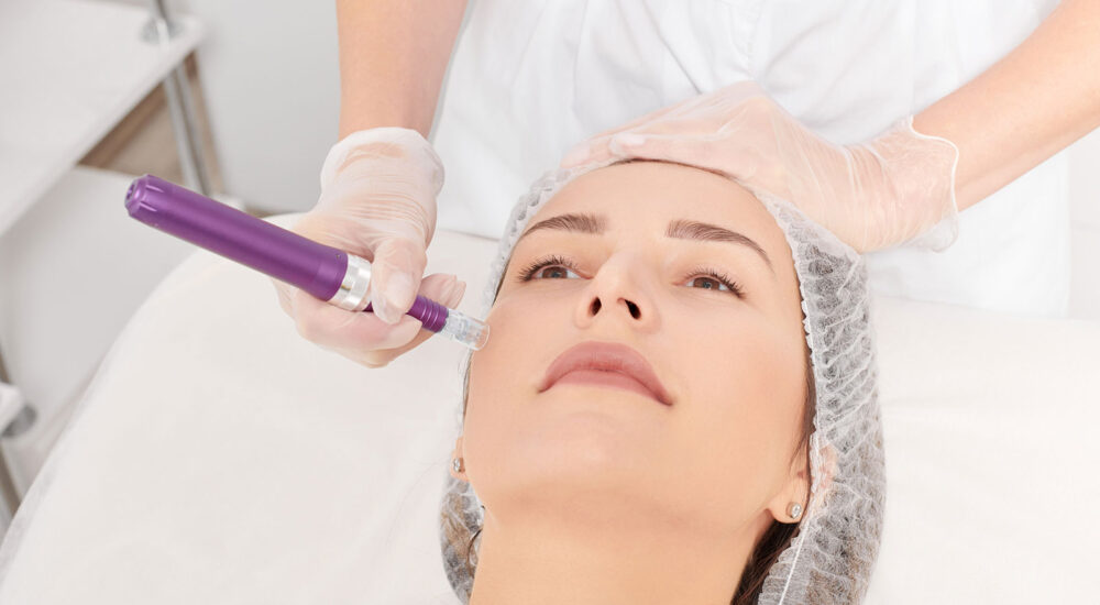 dermapen